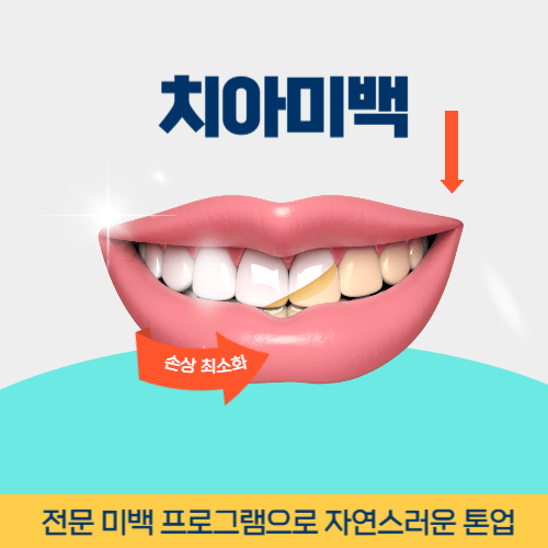 안성치과 안성시 치과 치아미백