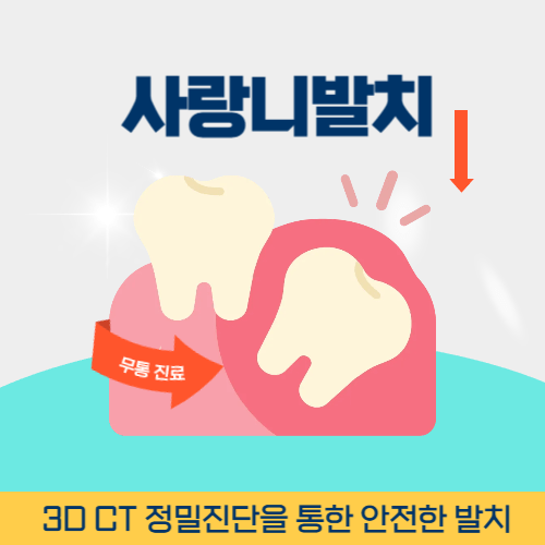 안성치과 안성시 치과 사랑니 발치